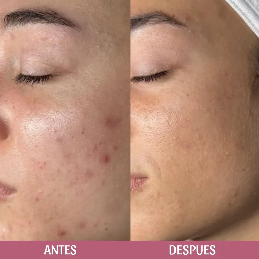Jabón en aceite, limpiador facial con Centella Asiática de Skin1004
