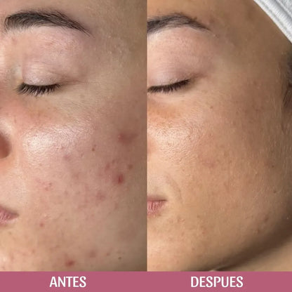 Jabón en aceite, limpiador facial con Centella Asiática de Skin1004