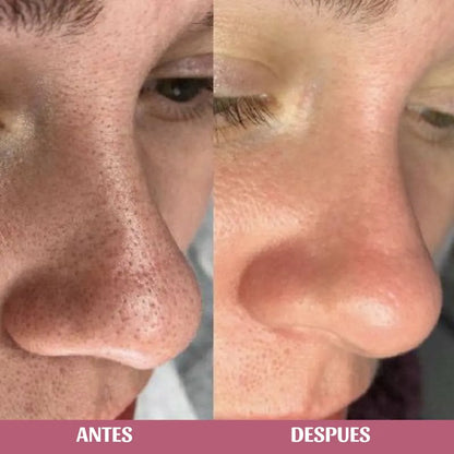Jabón en aceite, limpiador facial con Centella Asiática de Skin1004