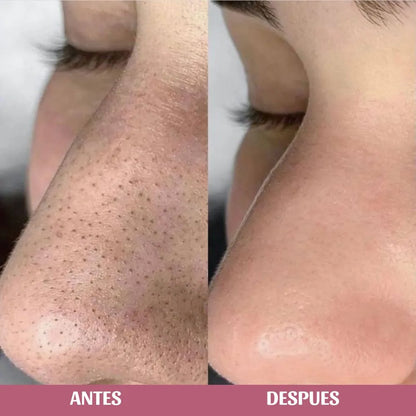 Jabón en aceite, limpiador facial con Centella Asiática de Skin1004