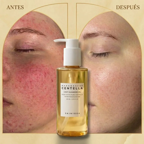 Jabón en aceite, limpiador facial con Centella Asiática de Skin1004